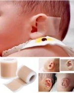 چسب اصلاح فرم گوش بچه